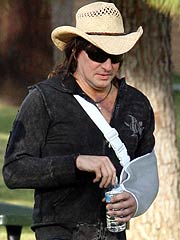 Bon Jovi's Richie Sambora Breaks His Arm