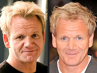 Gordon Ramsay's Newest Recipe: Cosmetic Procedure