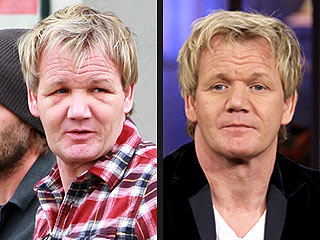Gordon Ramsay Plastic Surgery on Gordon Ramsay Explains His  Hair Nightmare  And Puffy Face   Health