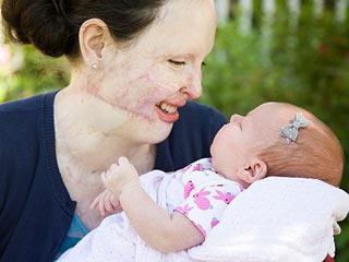 Plane Crash Survivor, Mommy Blogger Stephanie Nielson's Amazing Recovery