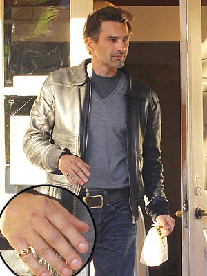 Olivier Martinez Shows Off Swollen Hand Post-Holiday Brawl