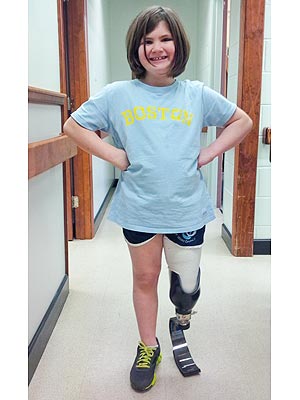 Boston Marathon Bombing Survivor Jane Richard Gets a New Leg