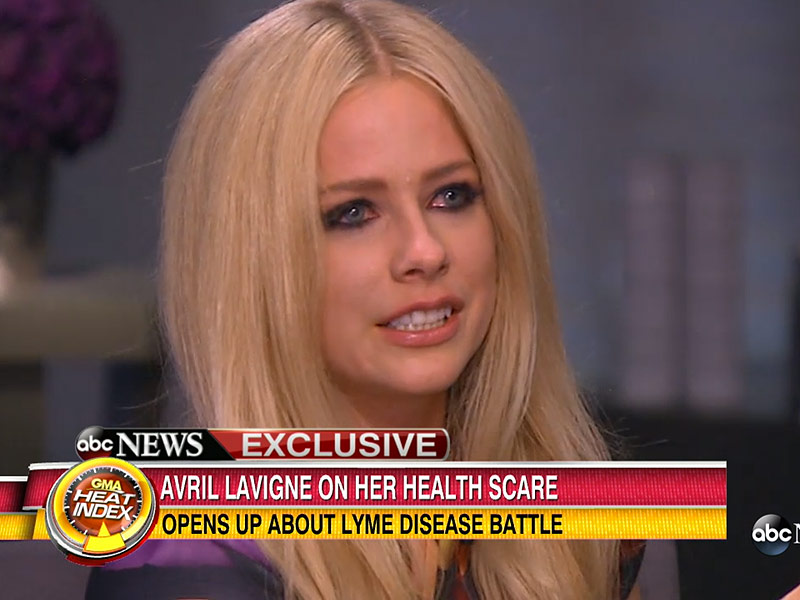 Avril Lavigne Lyme Disease Singer Breaks Down In Tears On Gma 