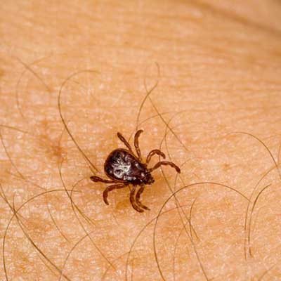 tick on human skin