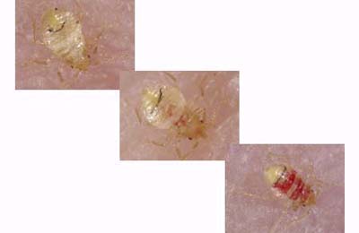 infant bedbug feeding