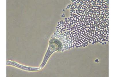 mold spore